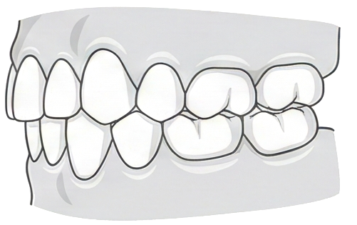 Slot 6